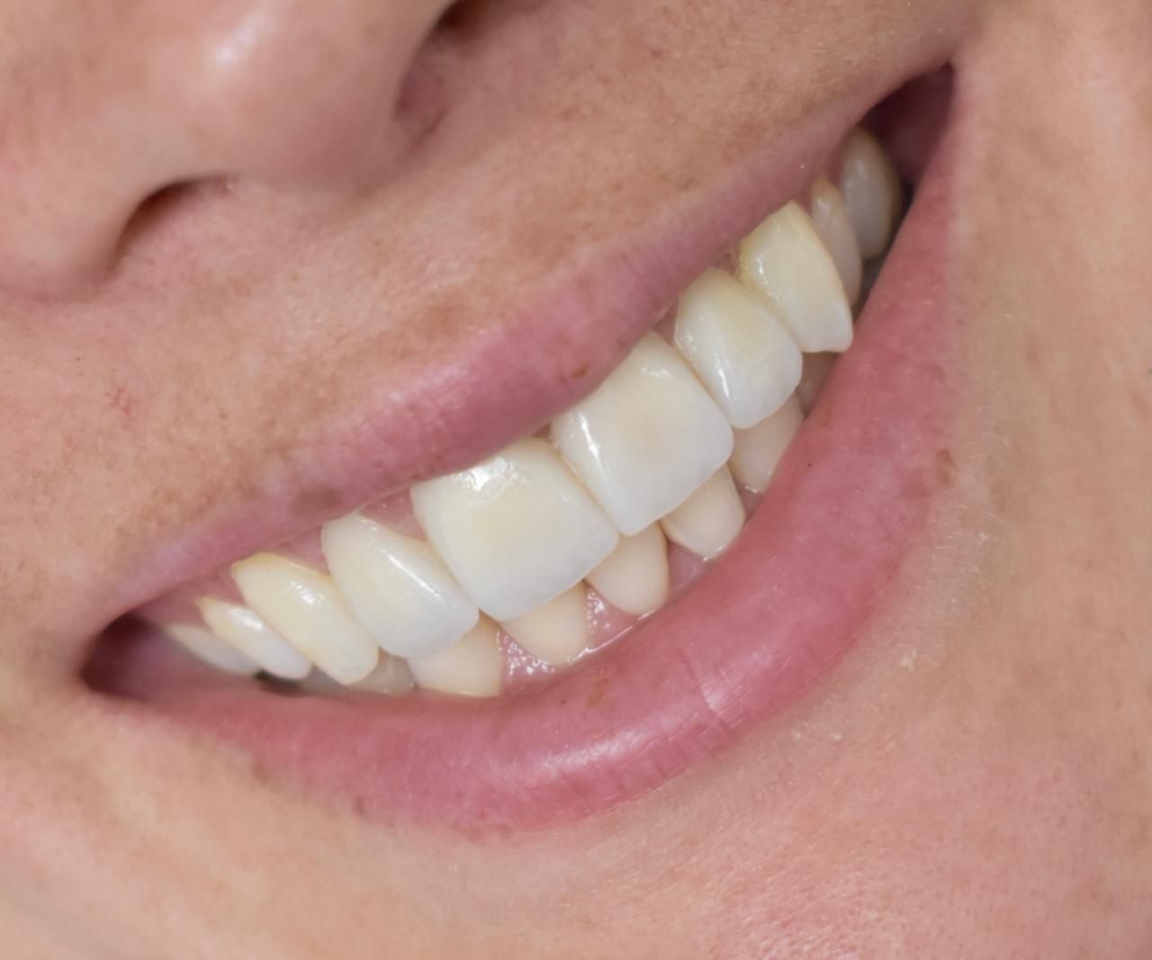 Juan Camilo Castillo-17