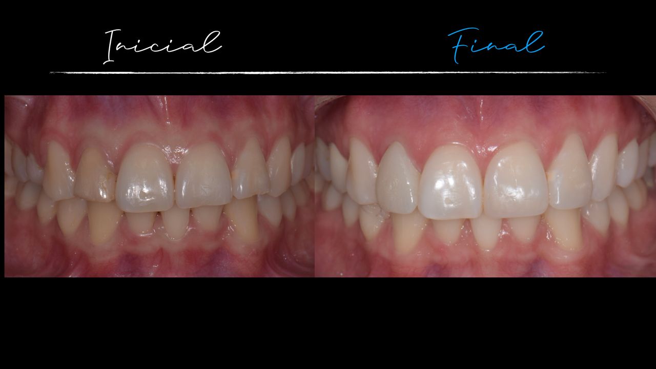 Matías Soto Parra-5