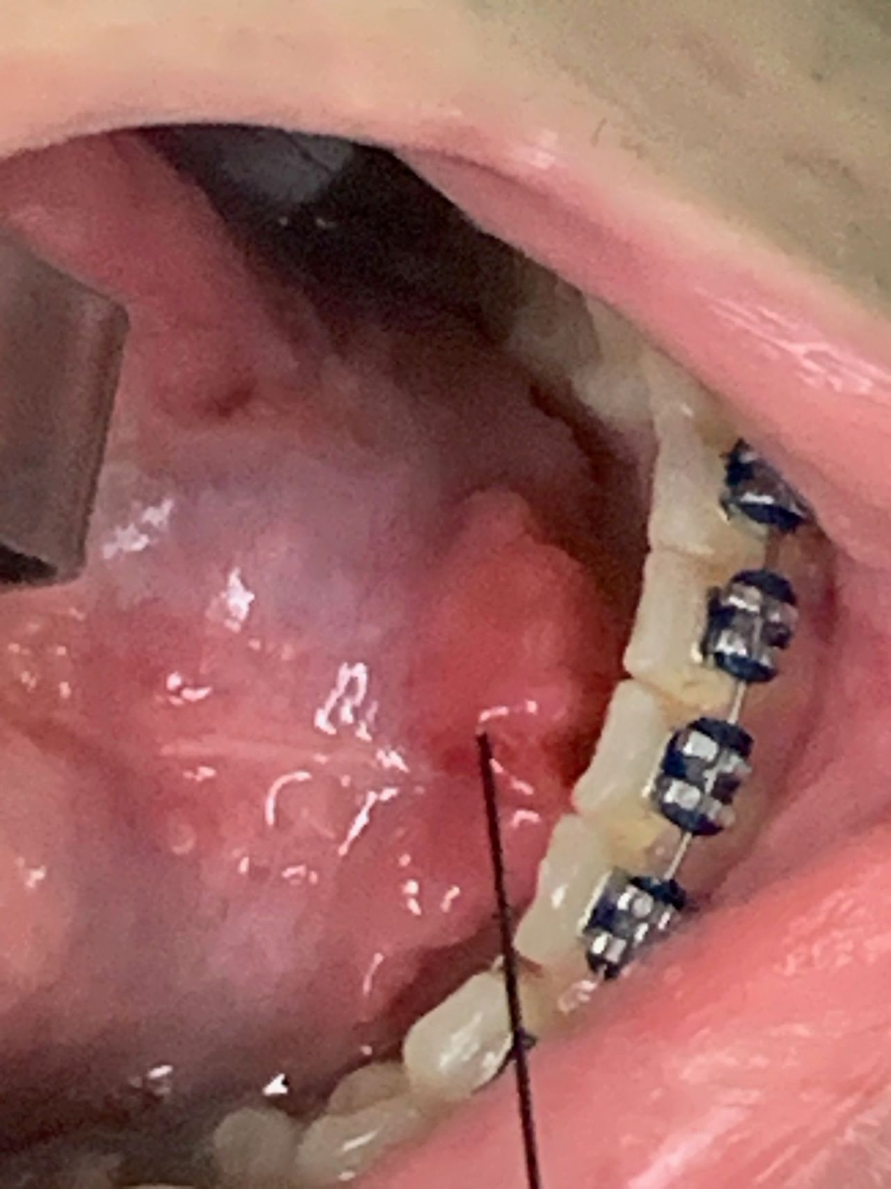 Giulianno Molina De Melo-19