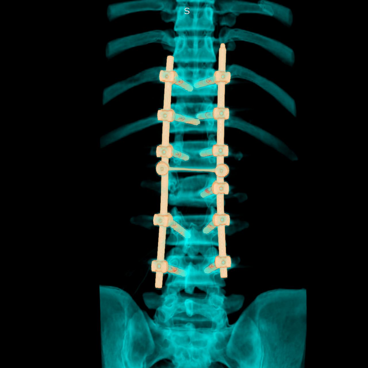 David Tafur Muñoz-1938