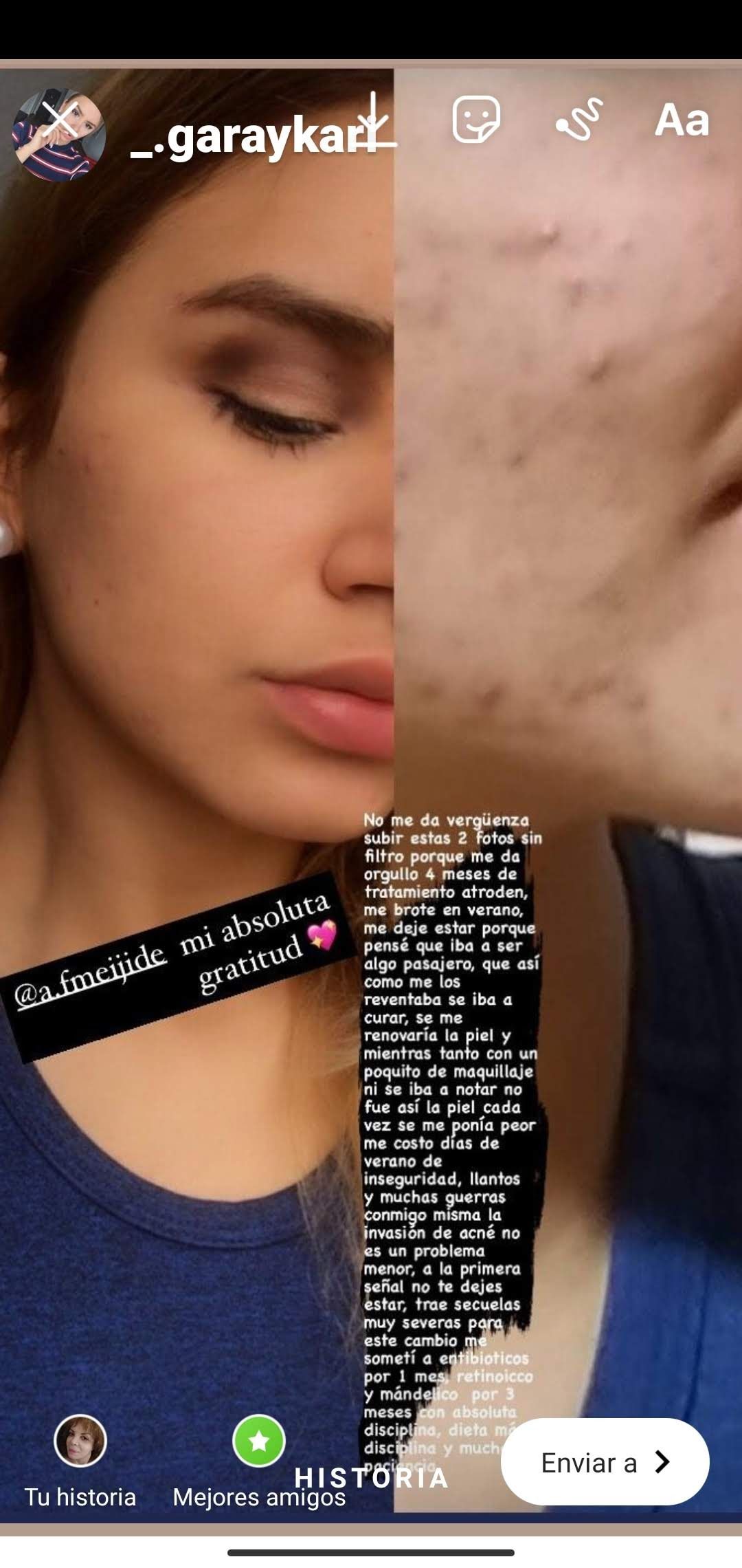 Alejandra Meijide-37