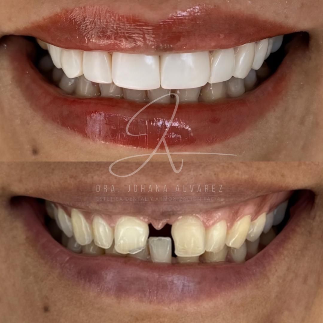 Johana Alvarez Castaño-3