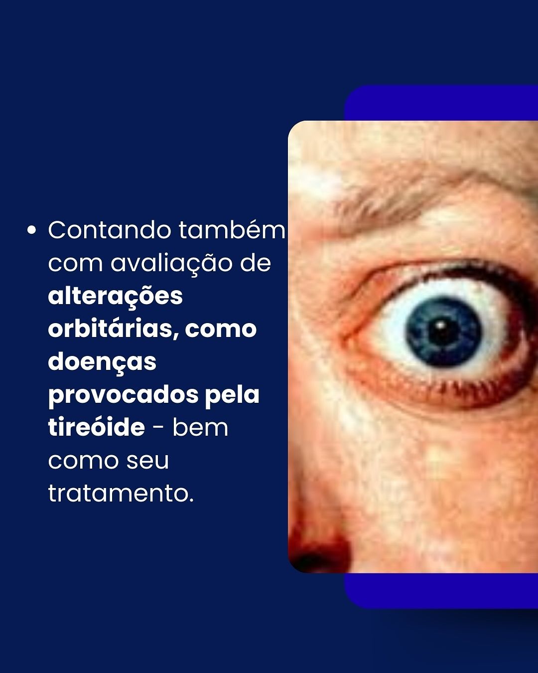 Araê De Oliveira-13