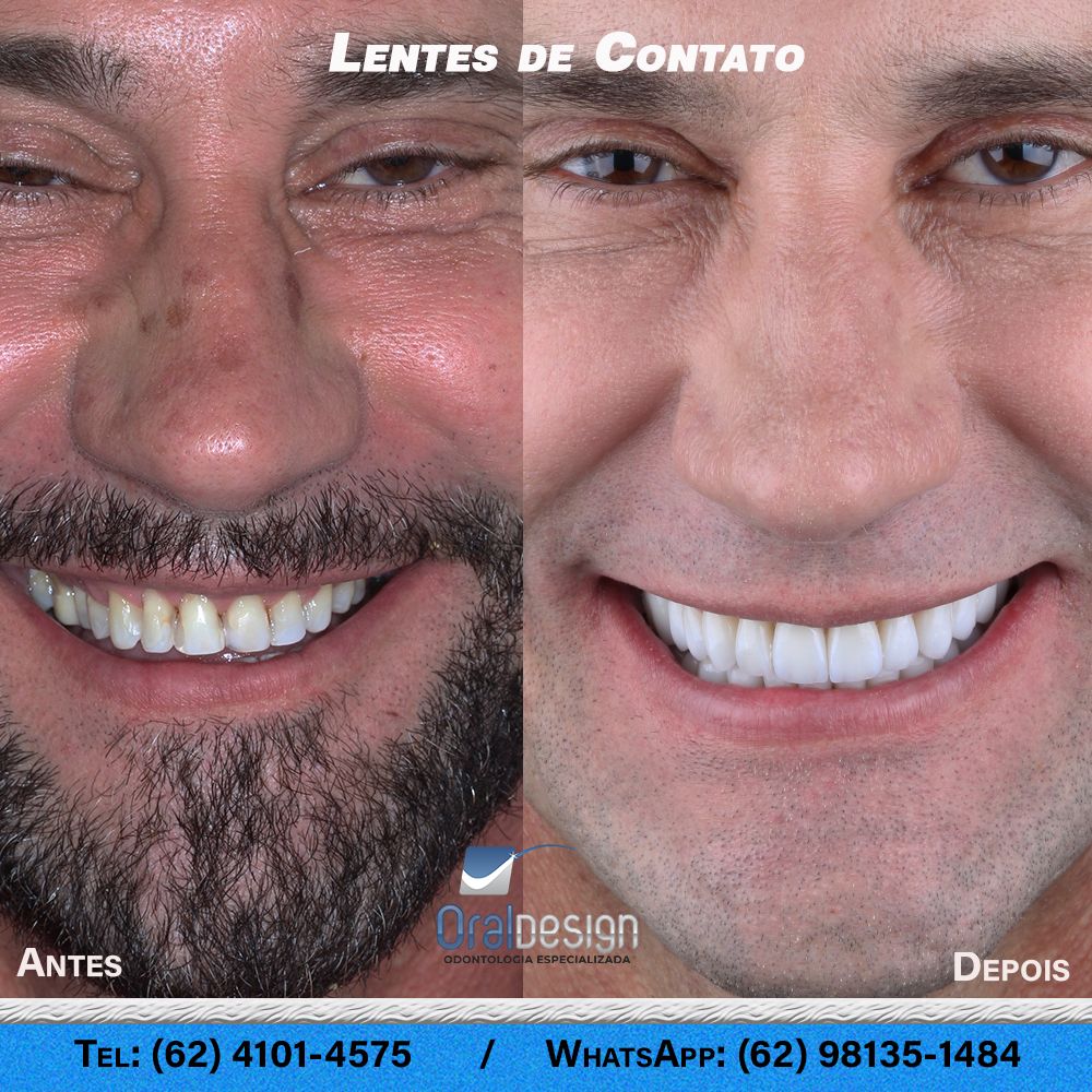 Danilo Monteiro Rezende Pereira-18