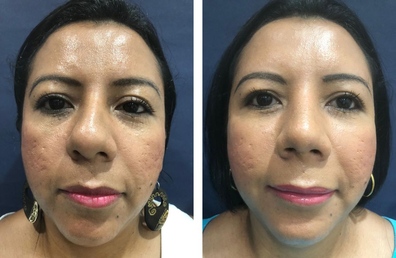 Jorge A Holguin Ruiz-17