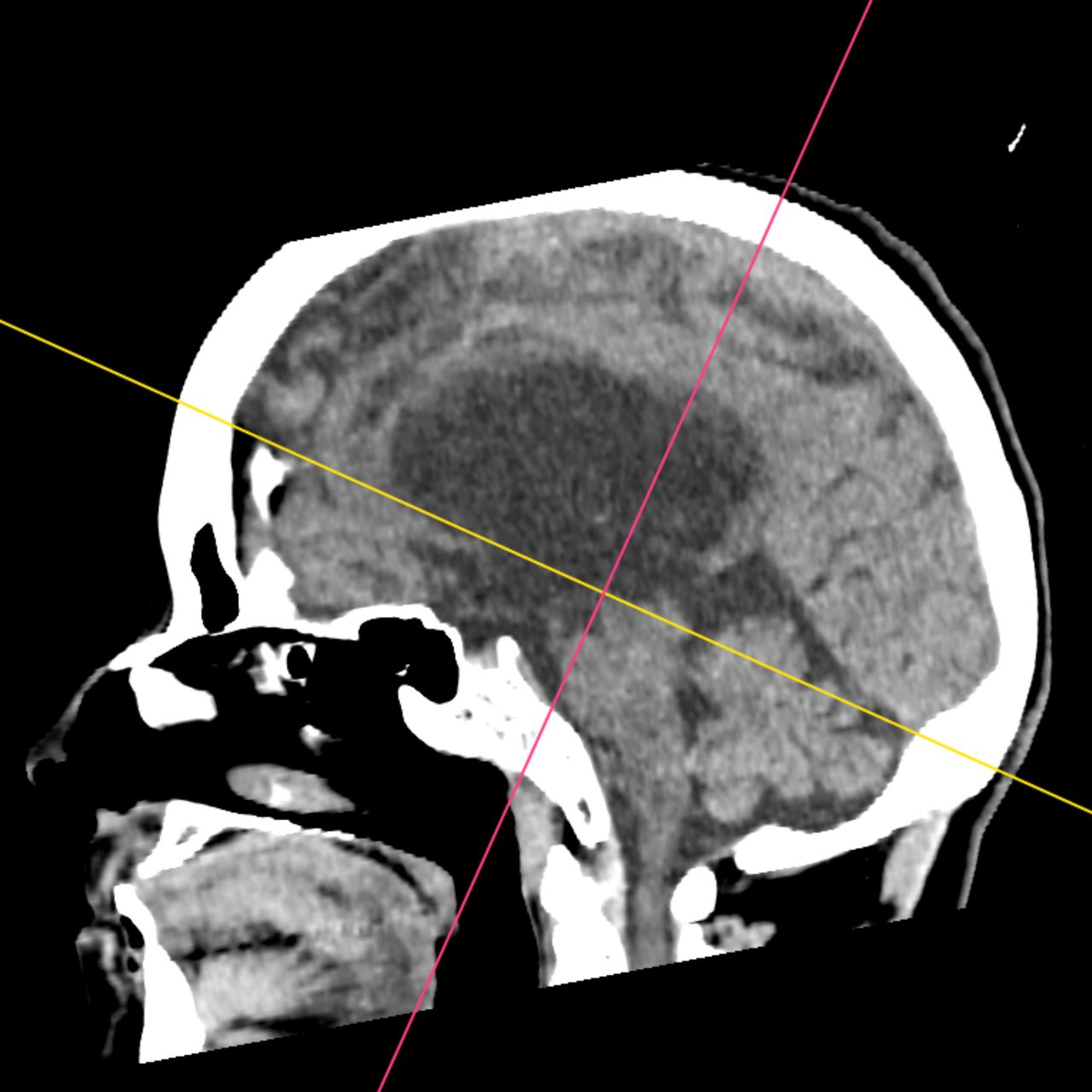 David Tafur Muñoz-1841