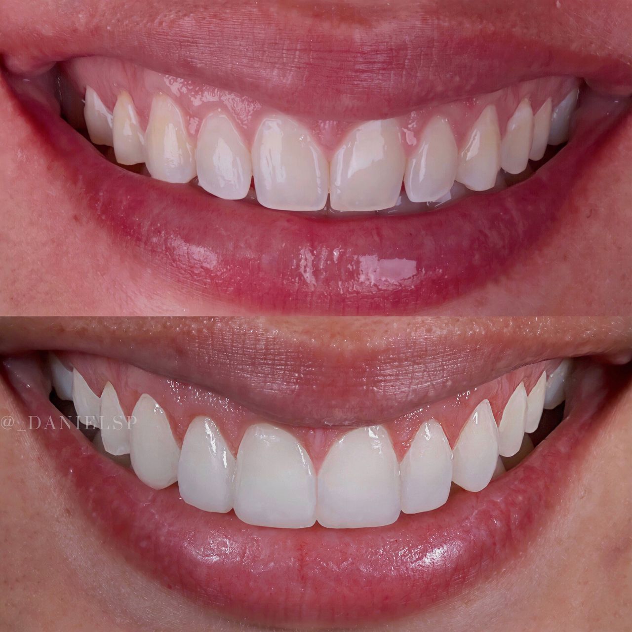 Daniel De Souza Pereira-44