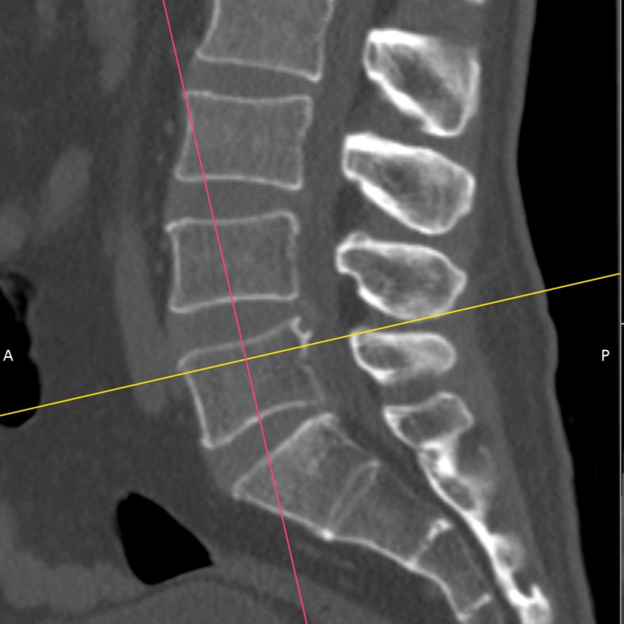 David Tafur Muñoz-1839