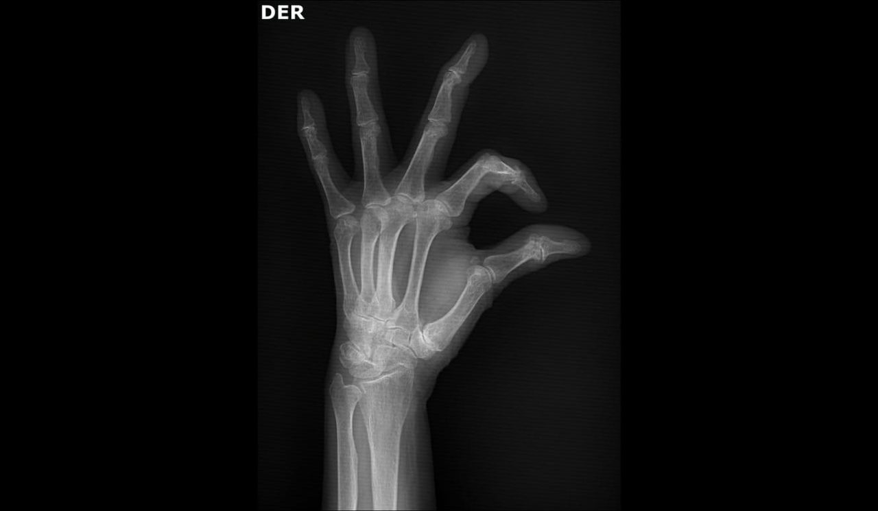 Robinson Andrés Mantilla A.-3