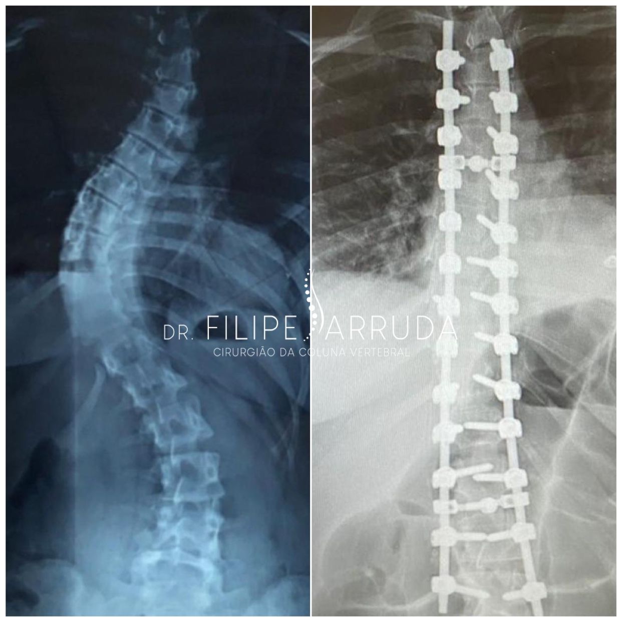 Filipe Arruda-16