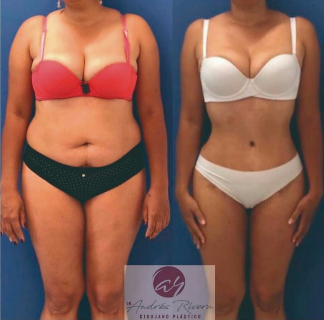 Andrés Rivera López-54