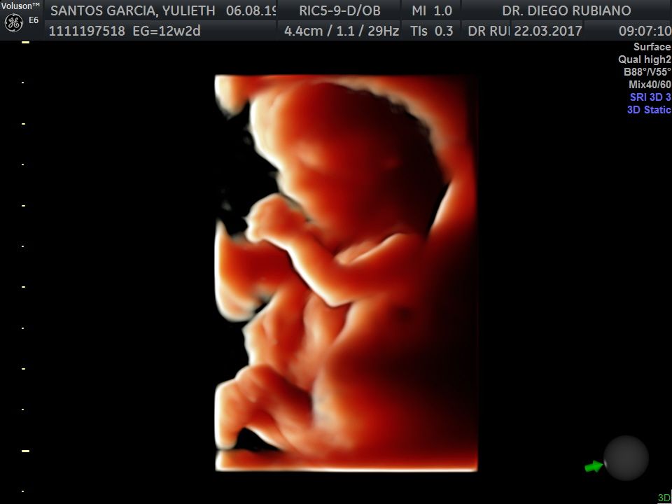 Diego Giovanni Rubiano Zarate-3