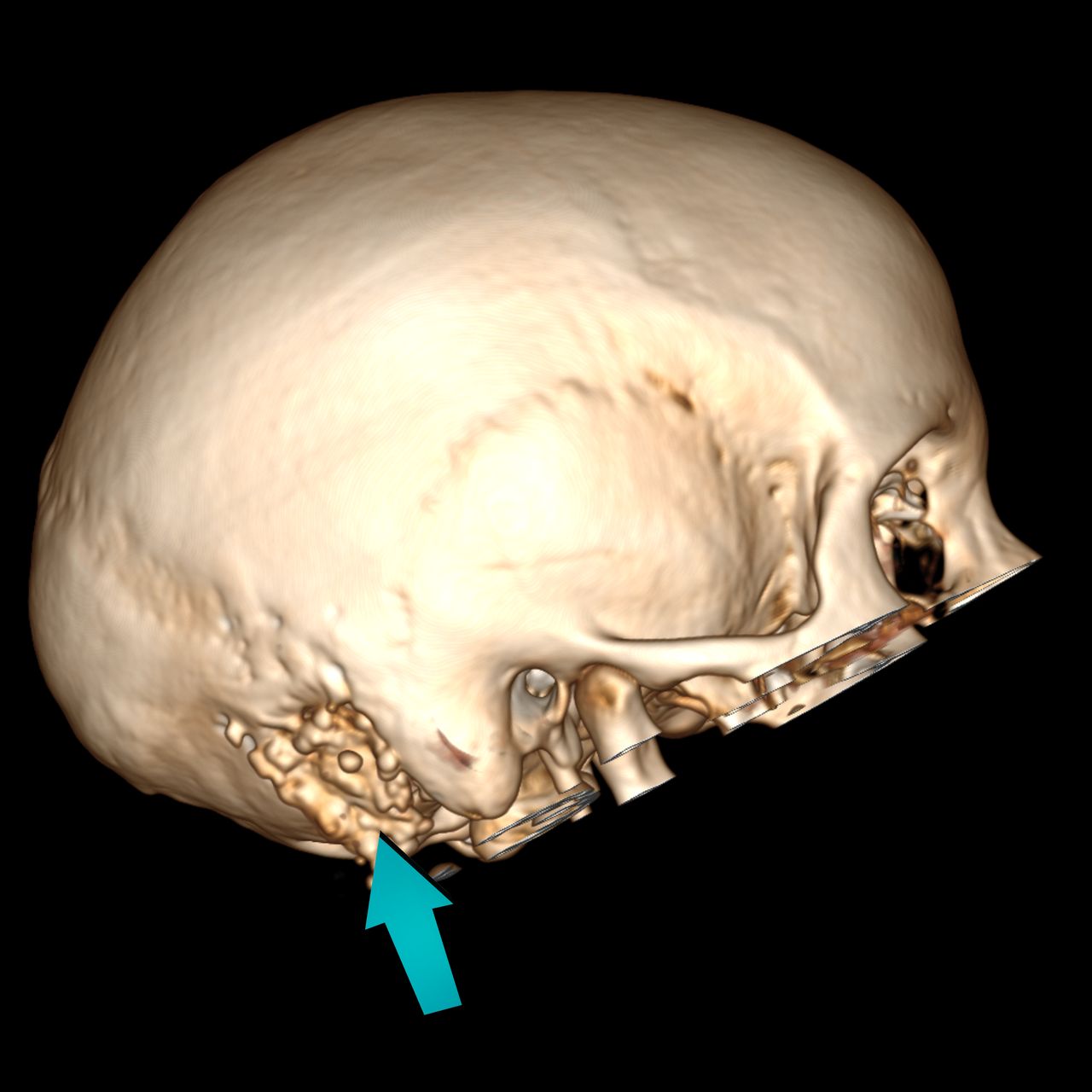 David Tafur Muñoz-1243