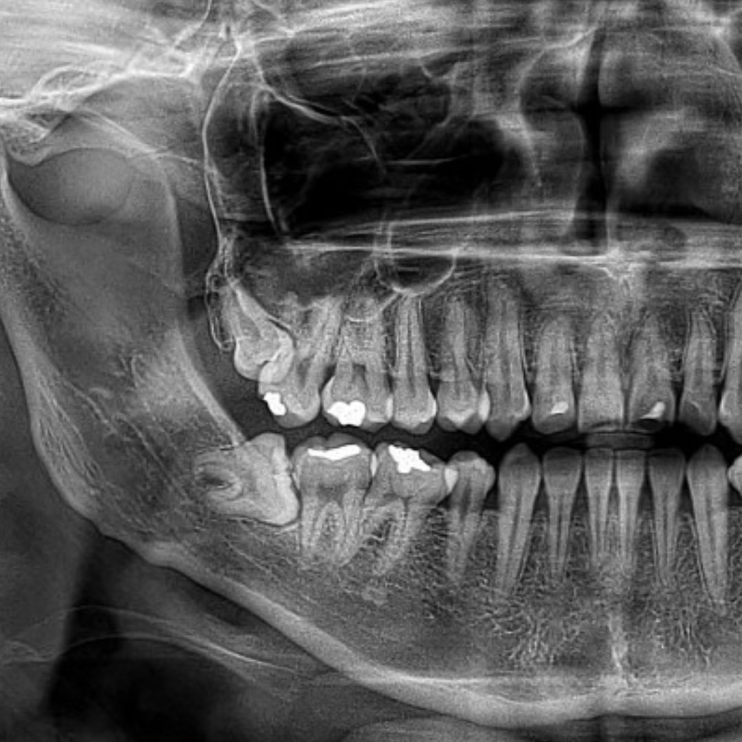 Cristian  Nilo Acevedo-4