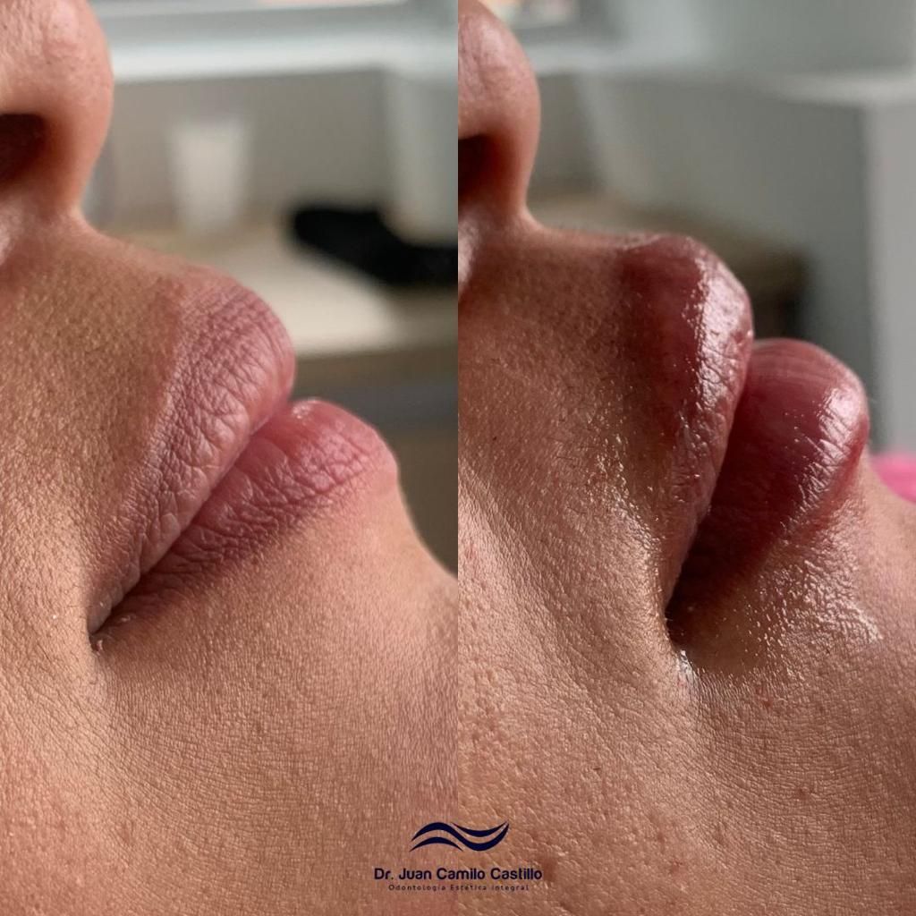 Juan Camilo Castillo-27