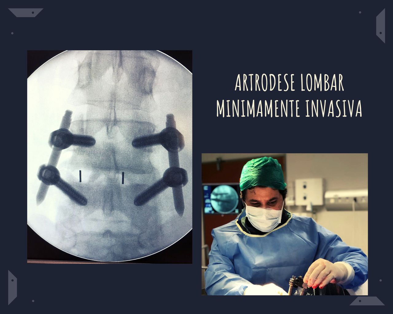 Marco Aurélio Severo Da Silva Versiani-55