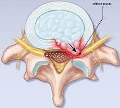 Raphael Teofilo De Souza-8