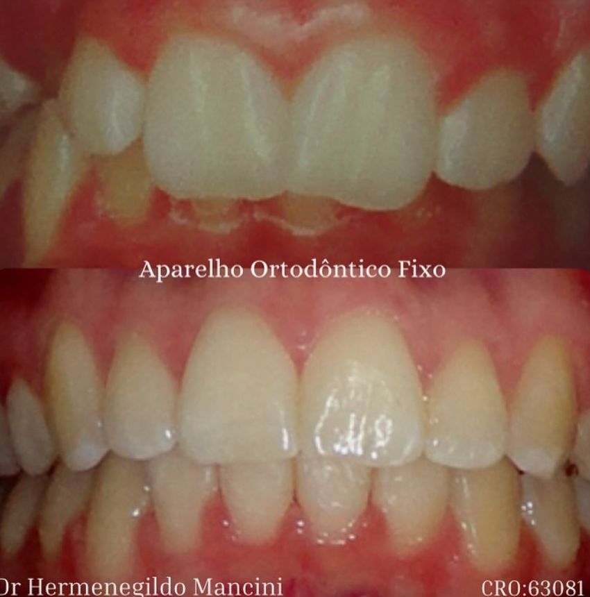 Hermenegildo Mancini-4