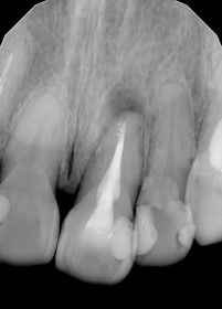 Hernán Andrés Febre Moscoso-14