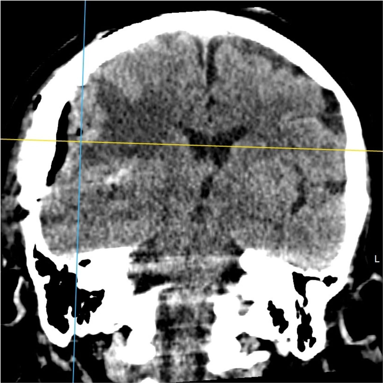 David Tafur Muñoz-1402