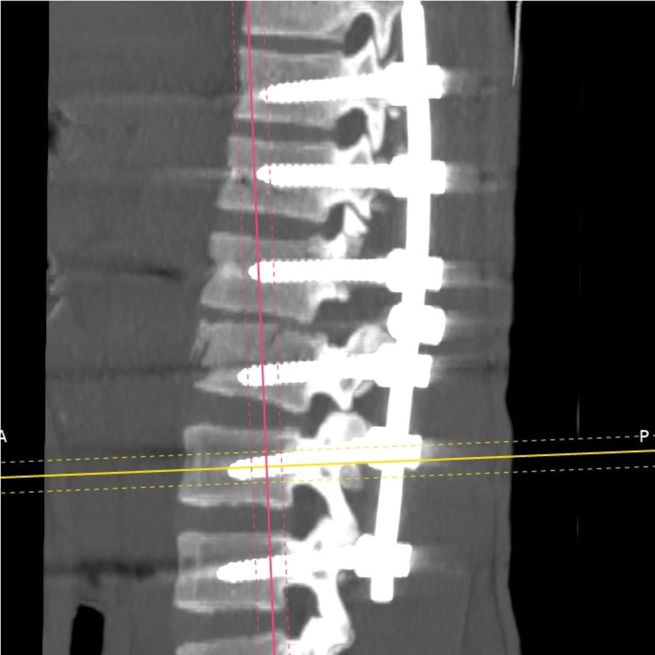 David Tafur Muñoz-1549