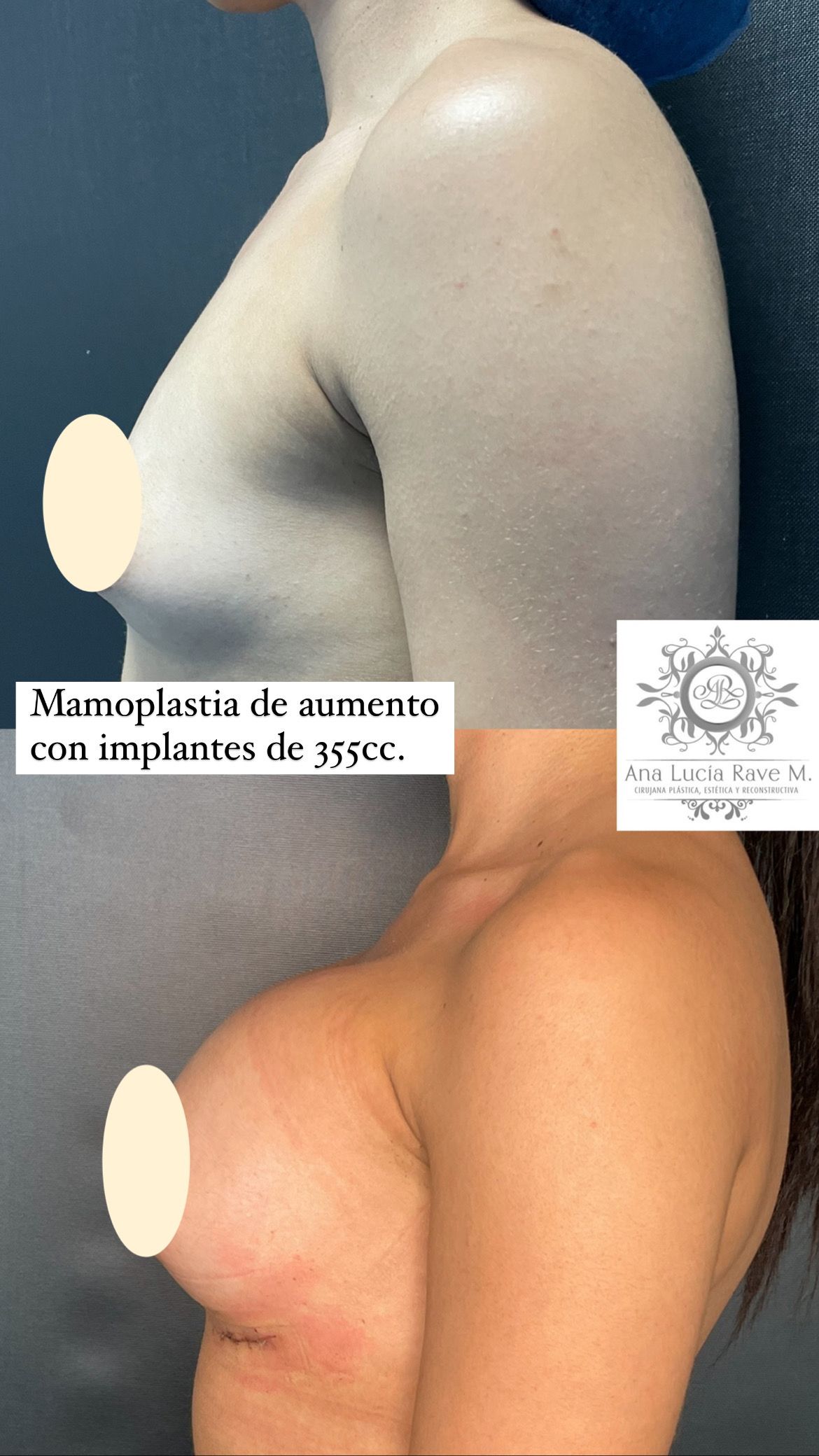 Ana Lucia Rave Martinez-15