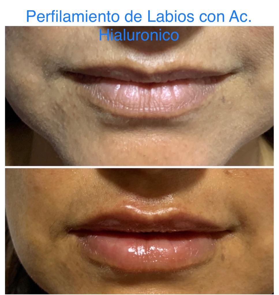 Maria Gisela Angel Losada-48