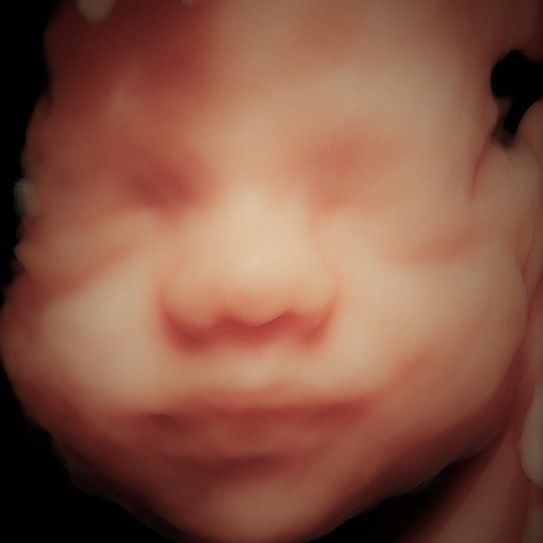 Charles Schwantz De Lima-22