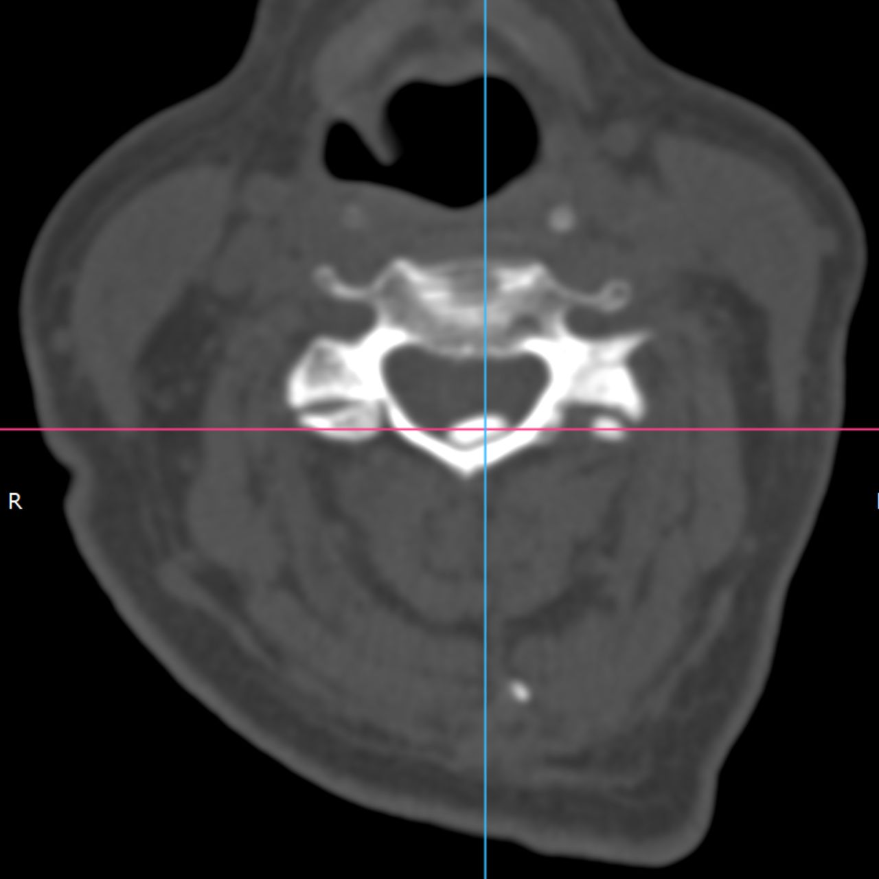 David Tafur Muñoz-2227