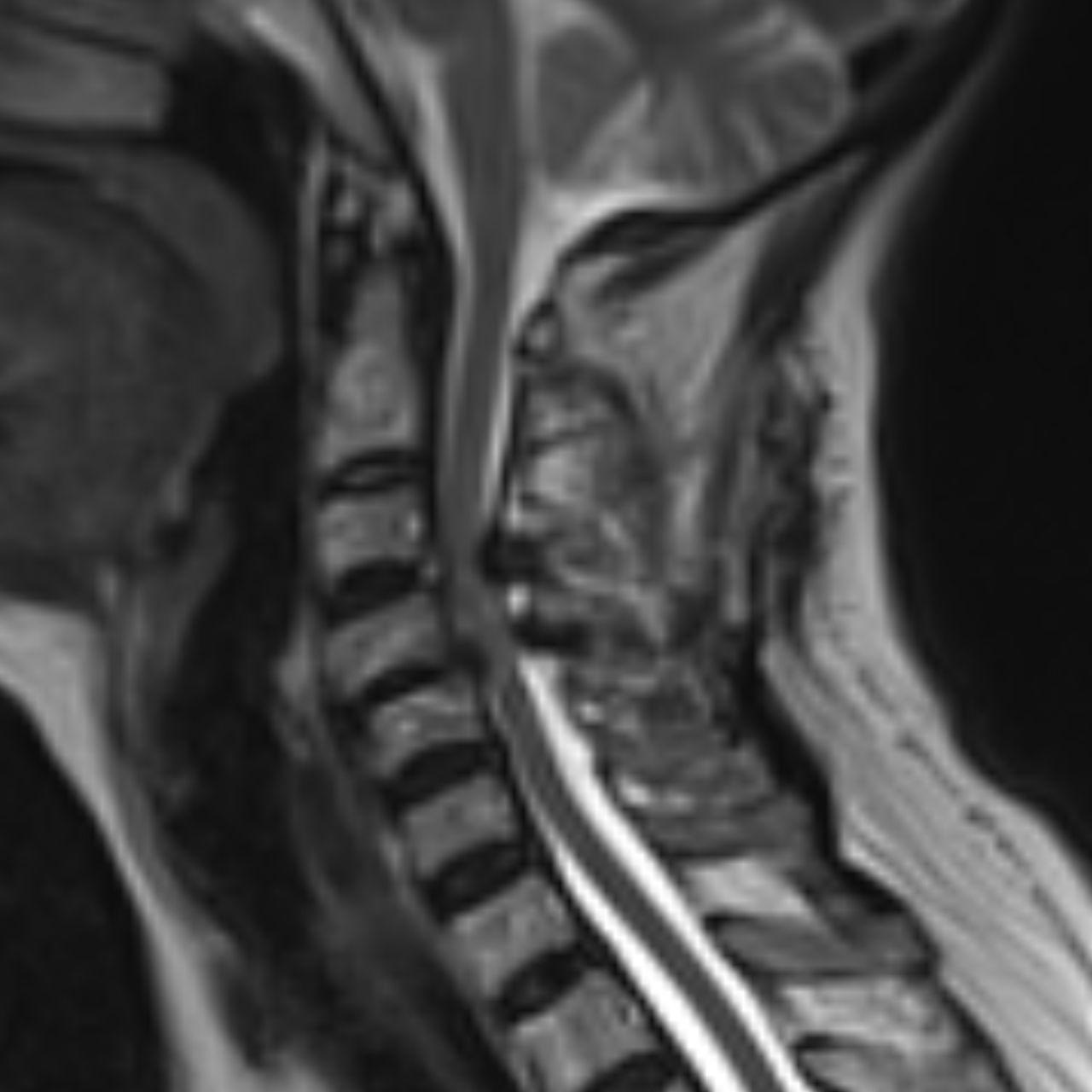 David Tafur Muñoz-1978