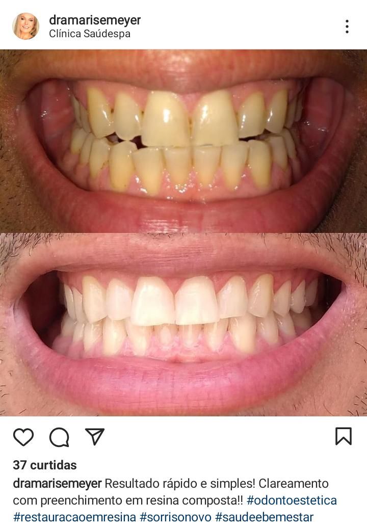 Marise Meyer Jamur-6