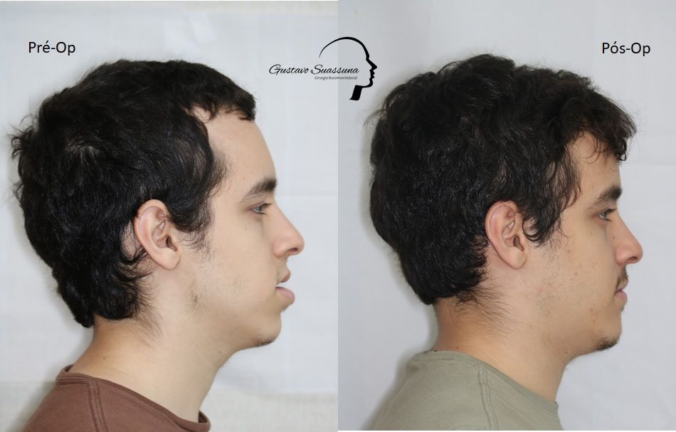 Gustavo Suassuna-26