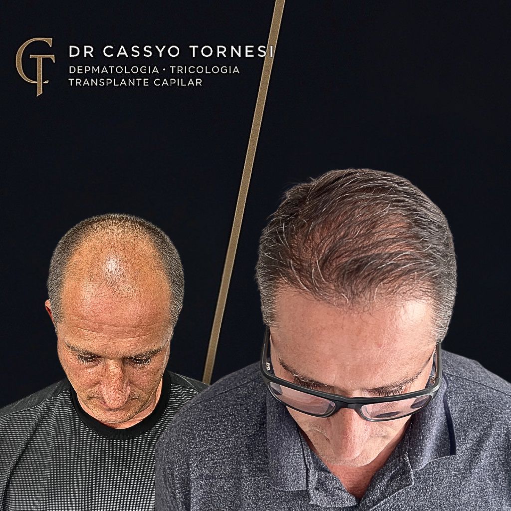 Cassyo Tornesi-13