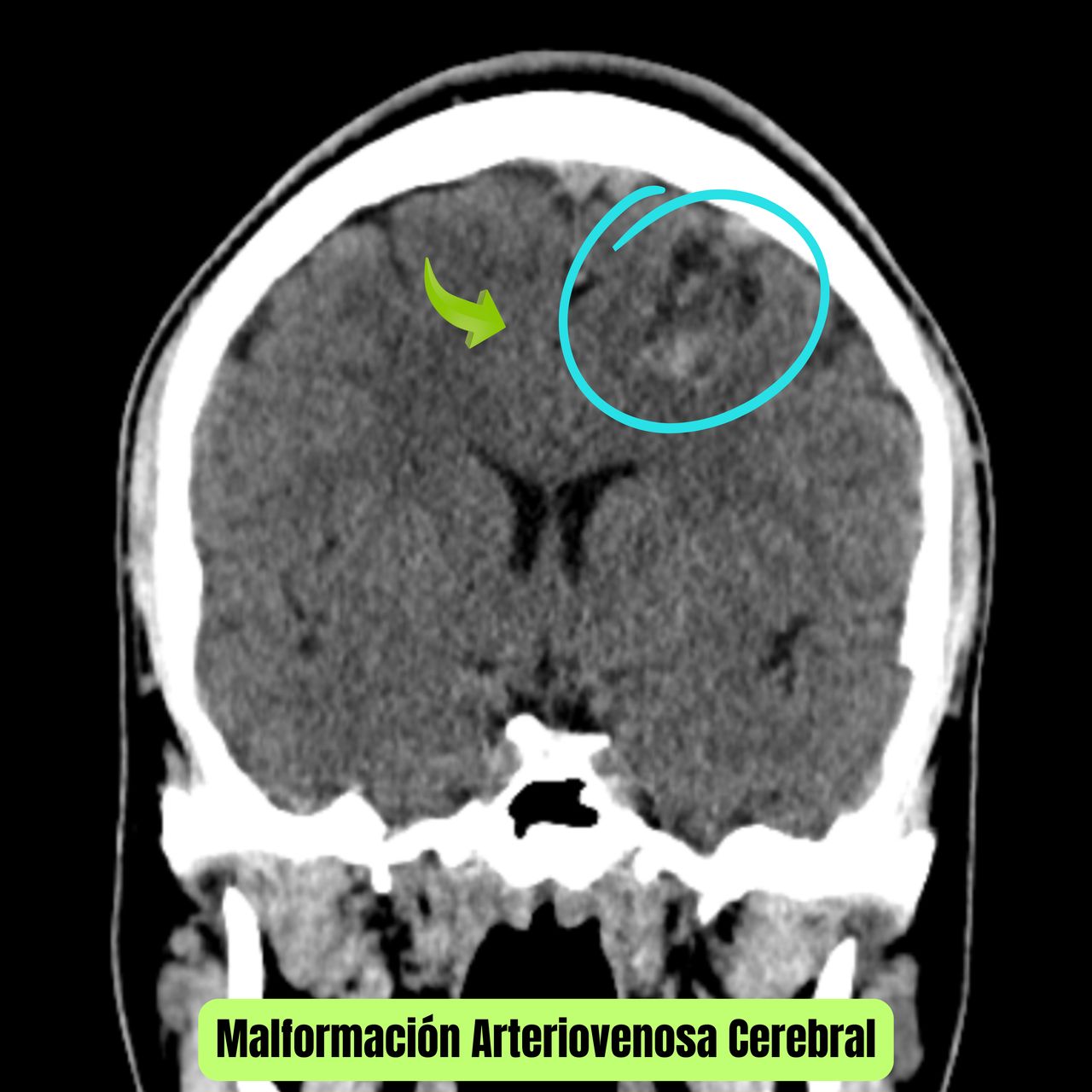 David Tafur Muñoz-1049