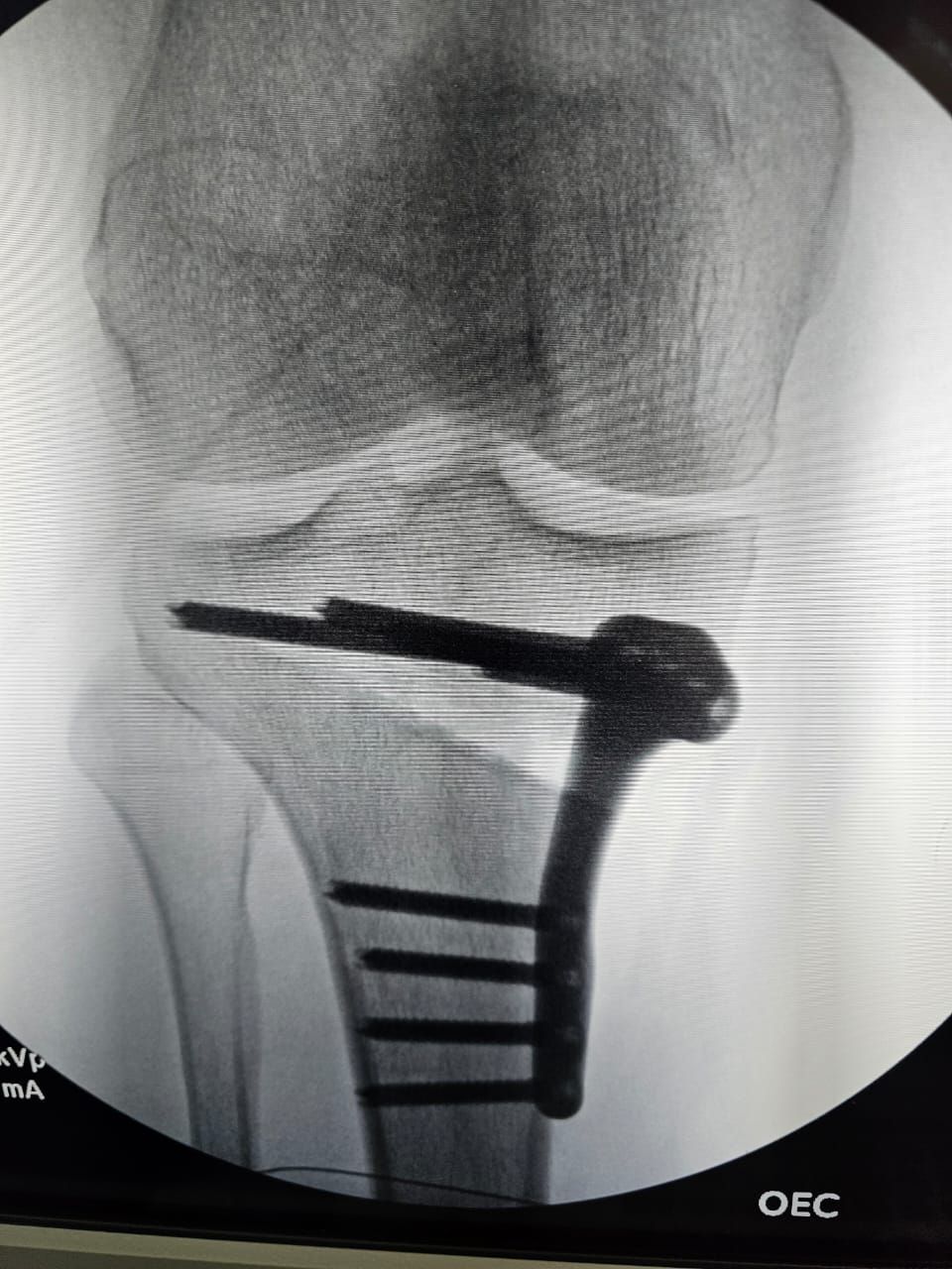 Jose Antonio Cordero Zirotti-4