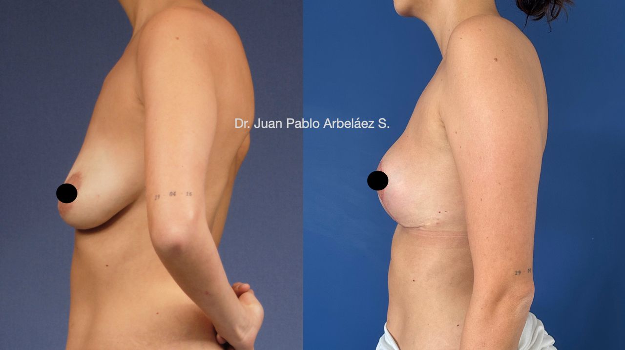 Juan Pablo Arbeláez Sierra-21