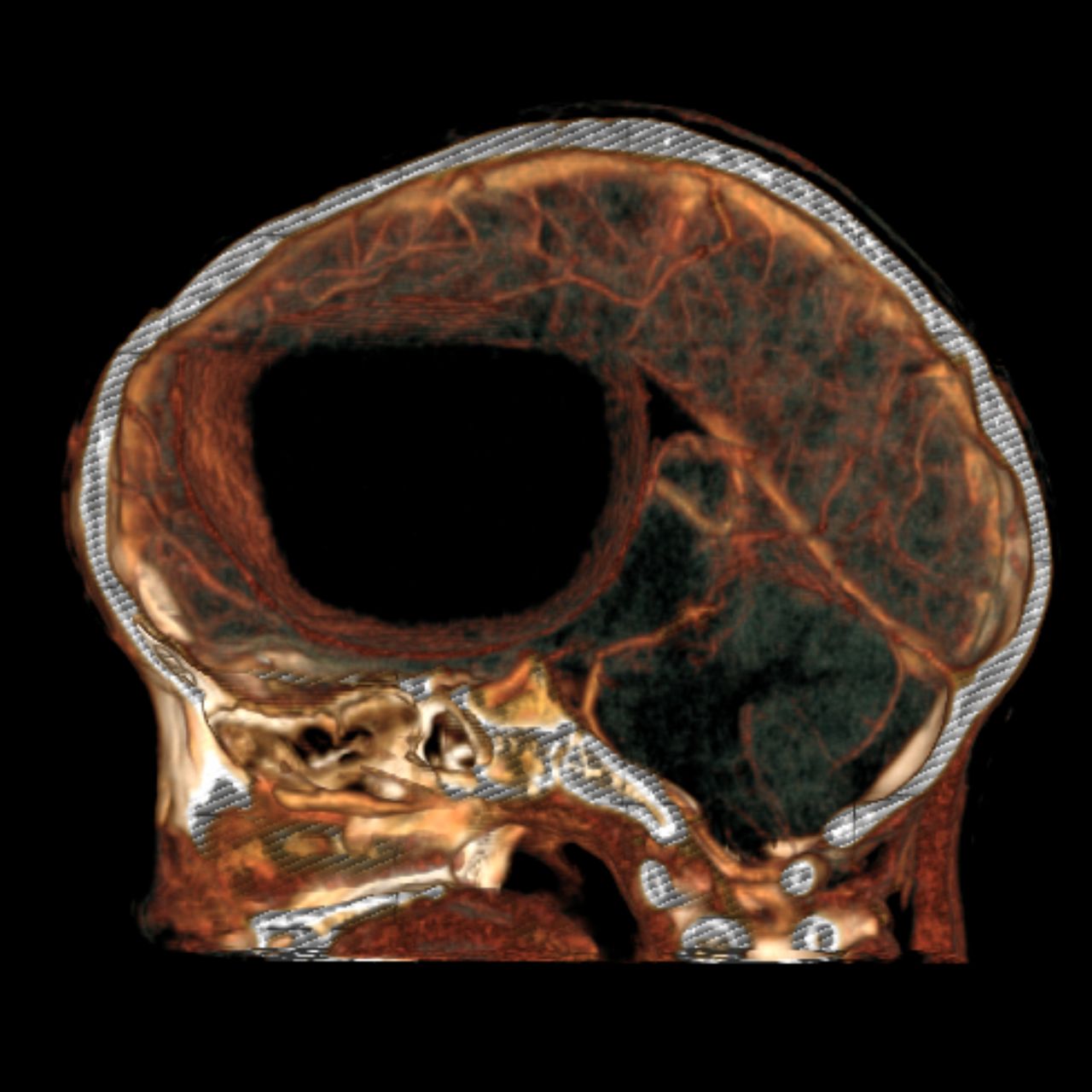 David Tafur Muñoz-1257