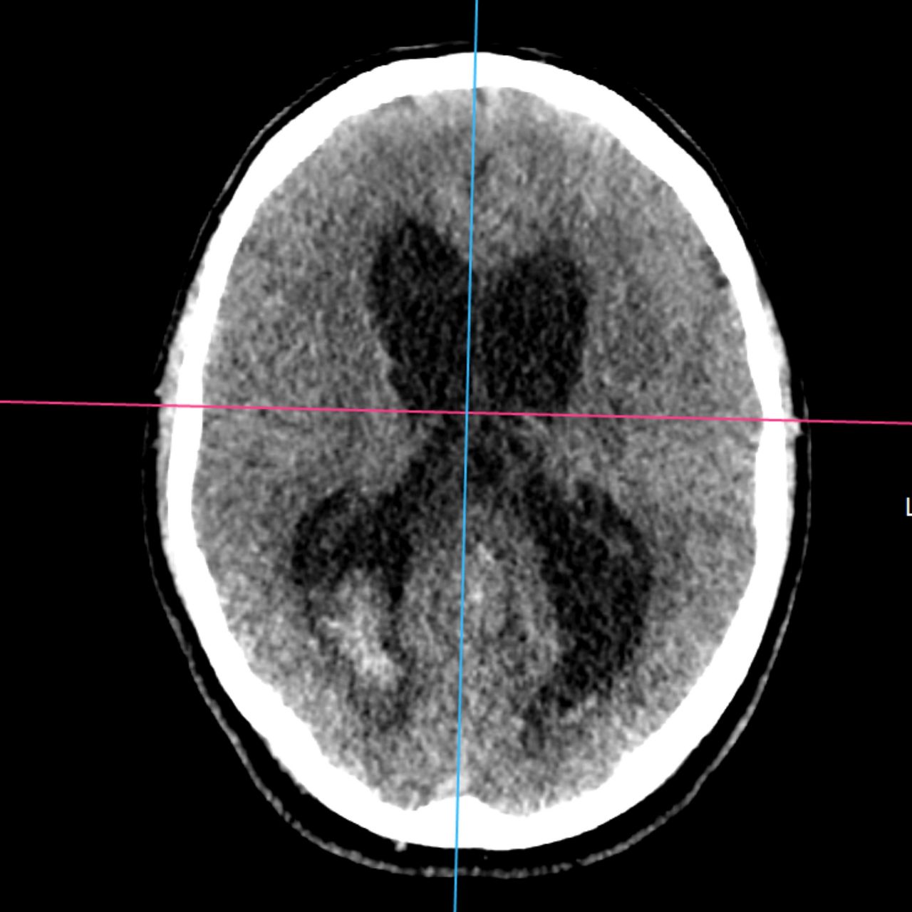 David Tafur Muñoz-2361