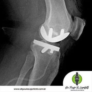 Paulo Roberto Capelletti-33