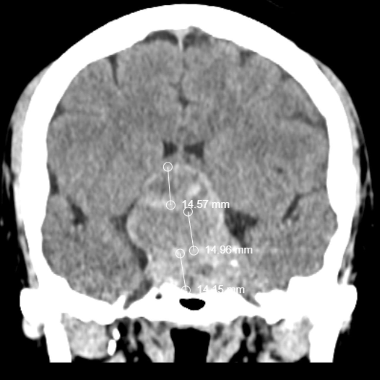 David Tafur Muñoz-1932