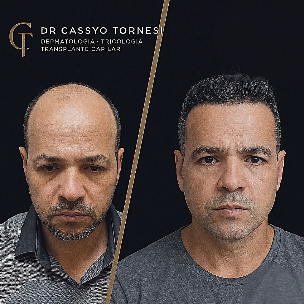 Cassyo Tornesi-11