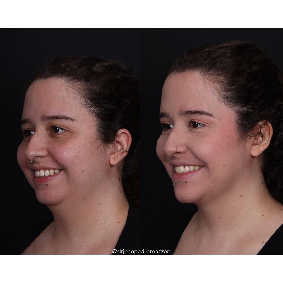 João Pedro Paulino Mazzon-31