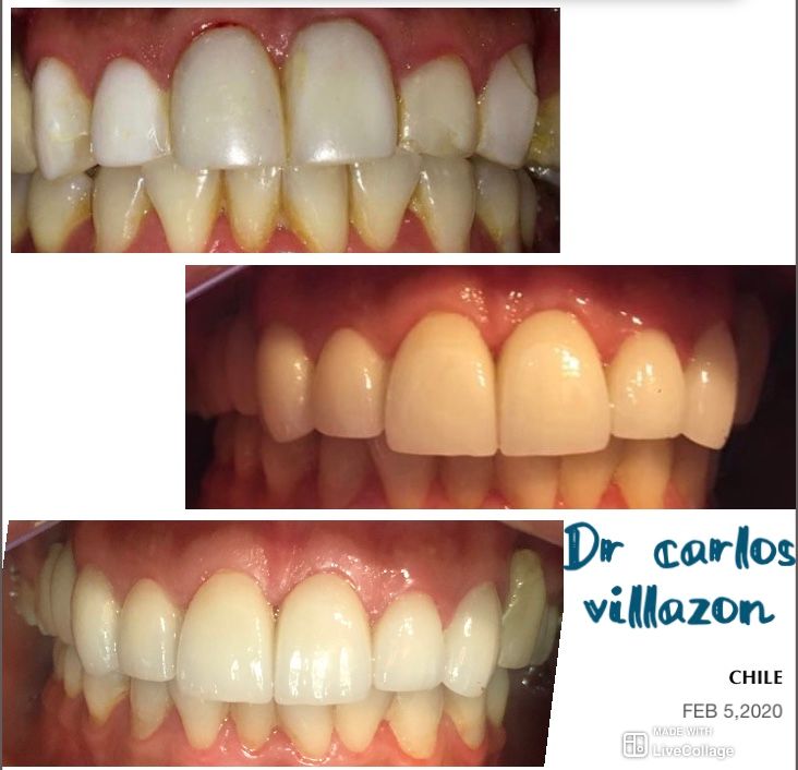 Carlos Andrés Villazón-29