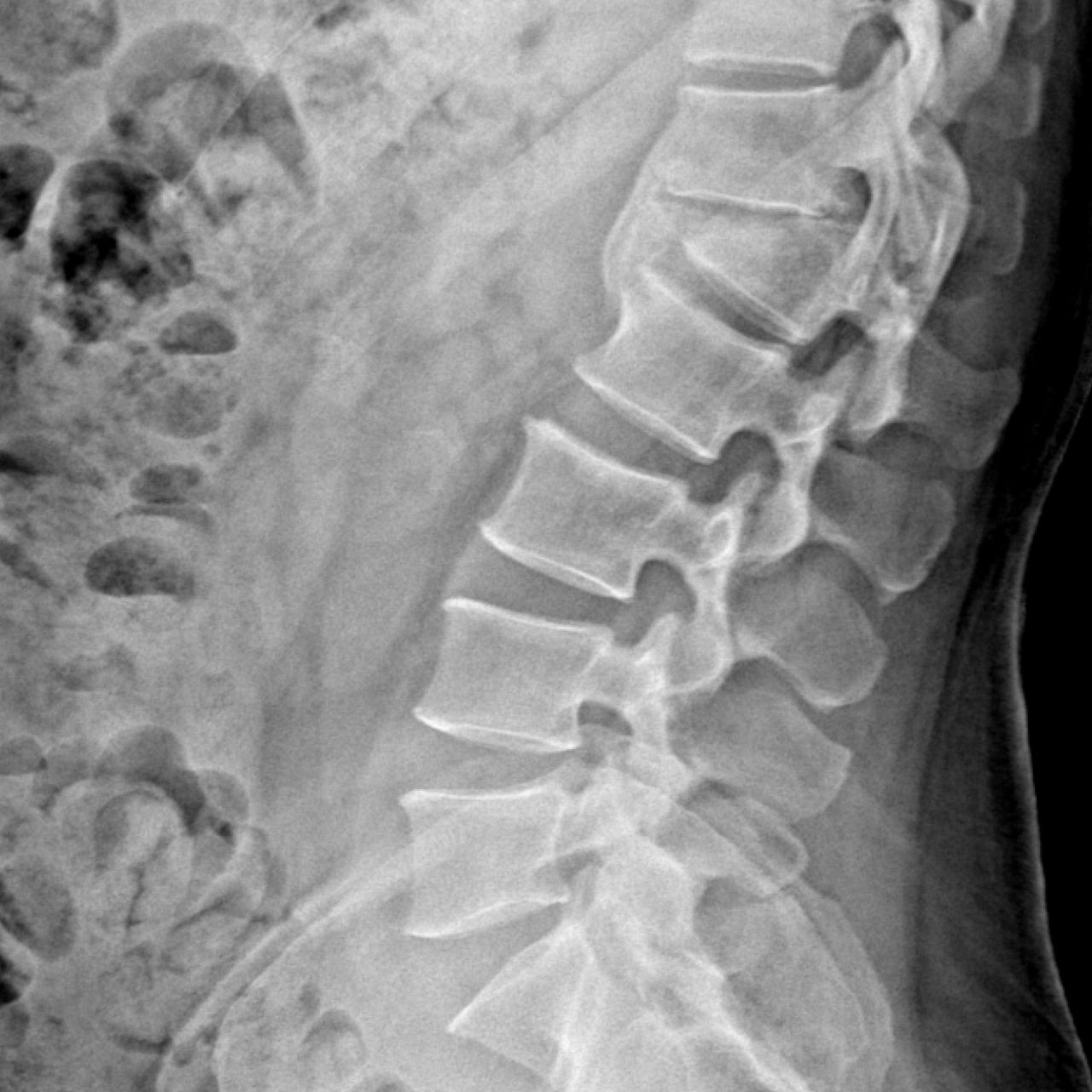 David Tafur Muñoz-1597