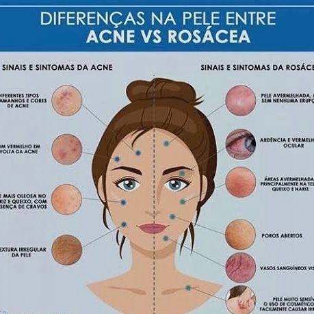 Ana Cristina Da Cruz Silva-107