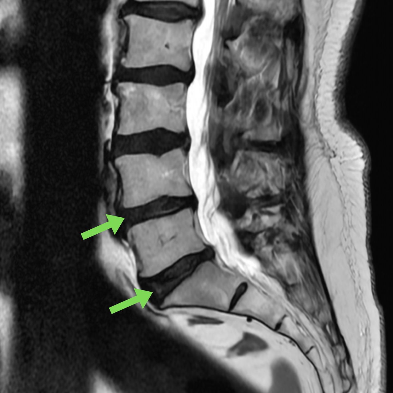 David Tafur Muñoz-1461