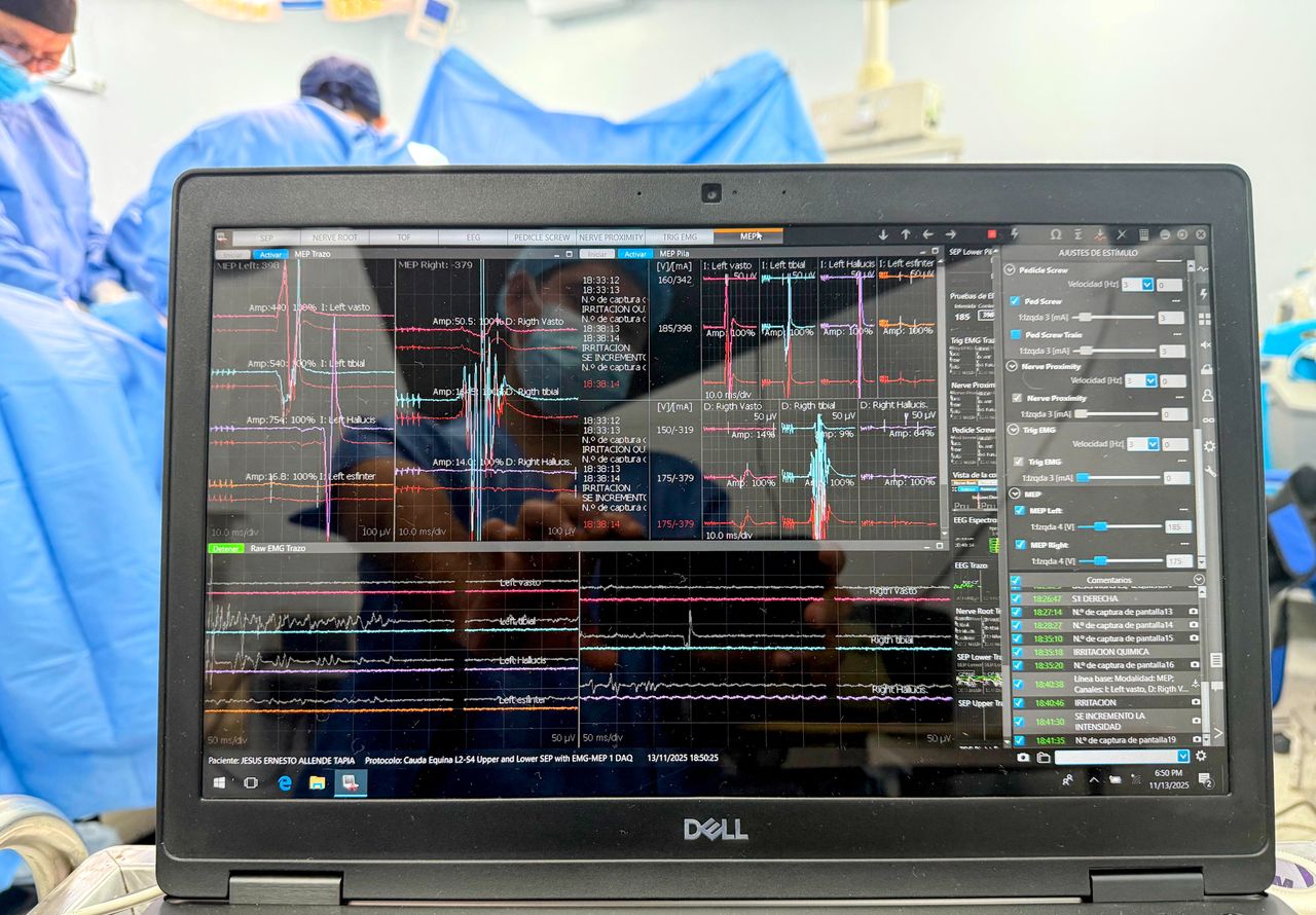 Juan Carlos Espinoza Retuerto-5