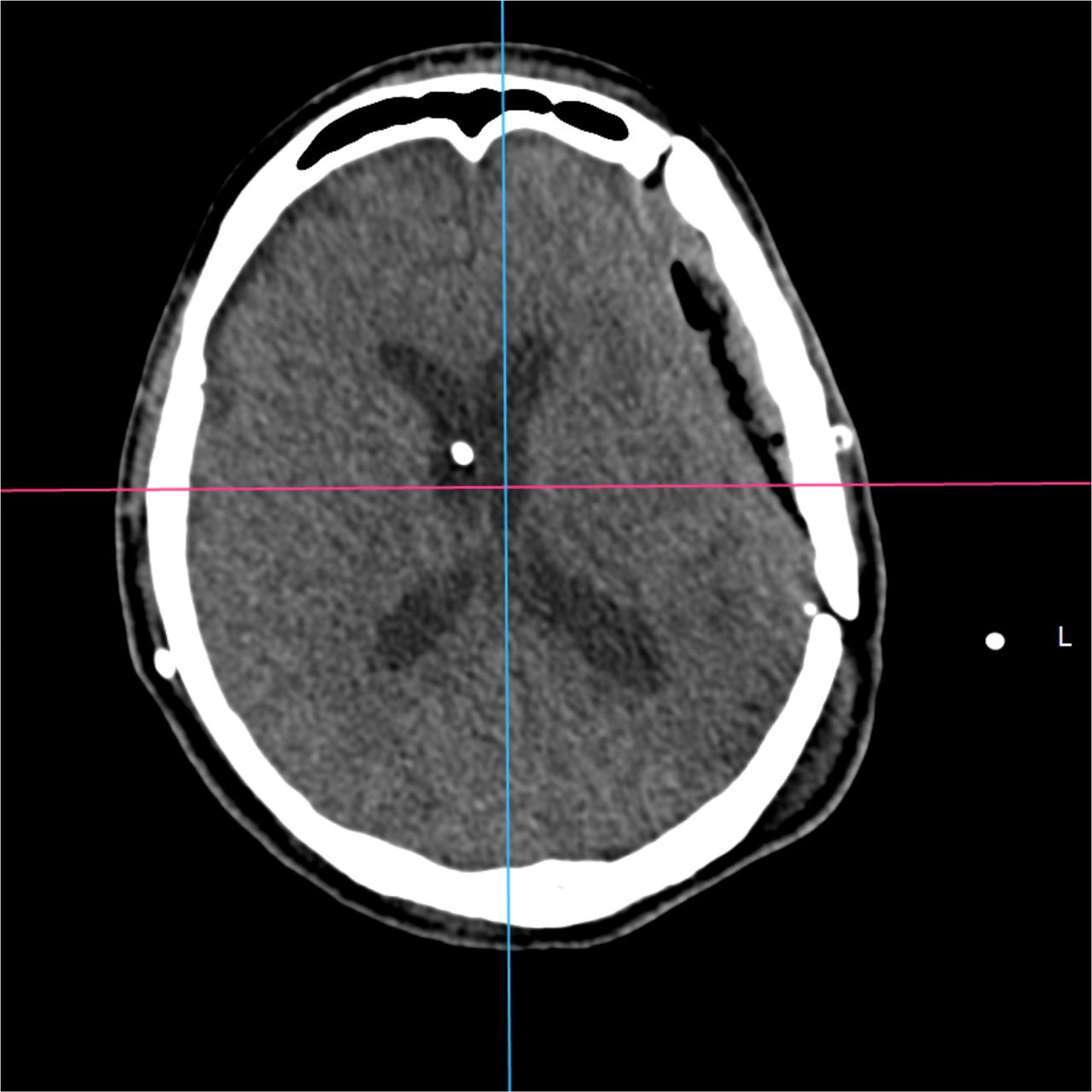 David Tafur Muñoz-2083