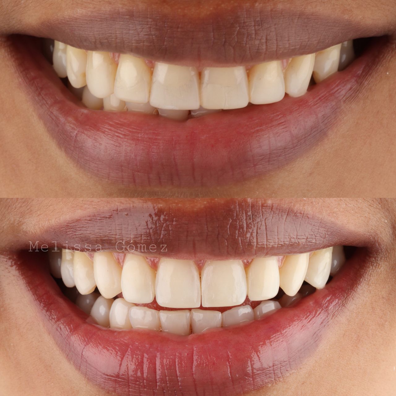 Melissa Gómez Arango-20