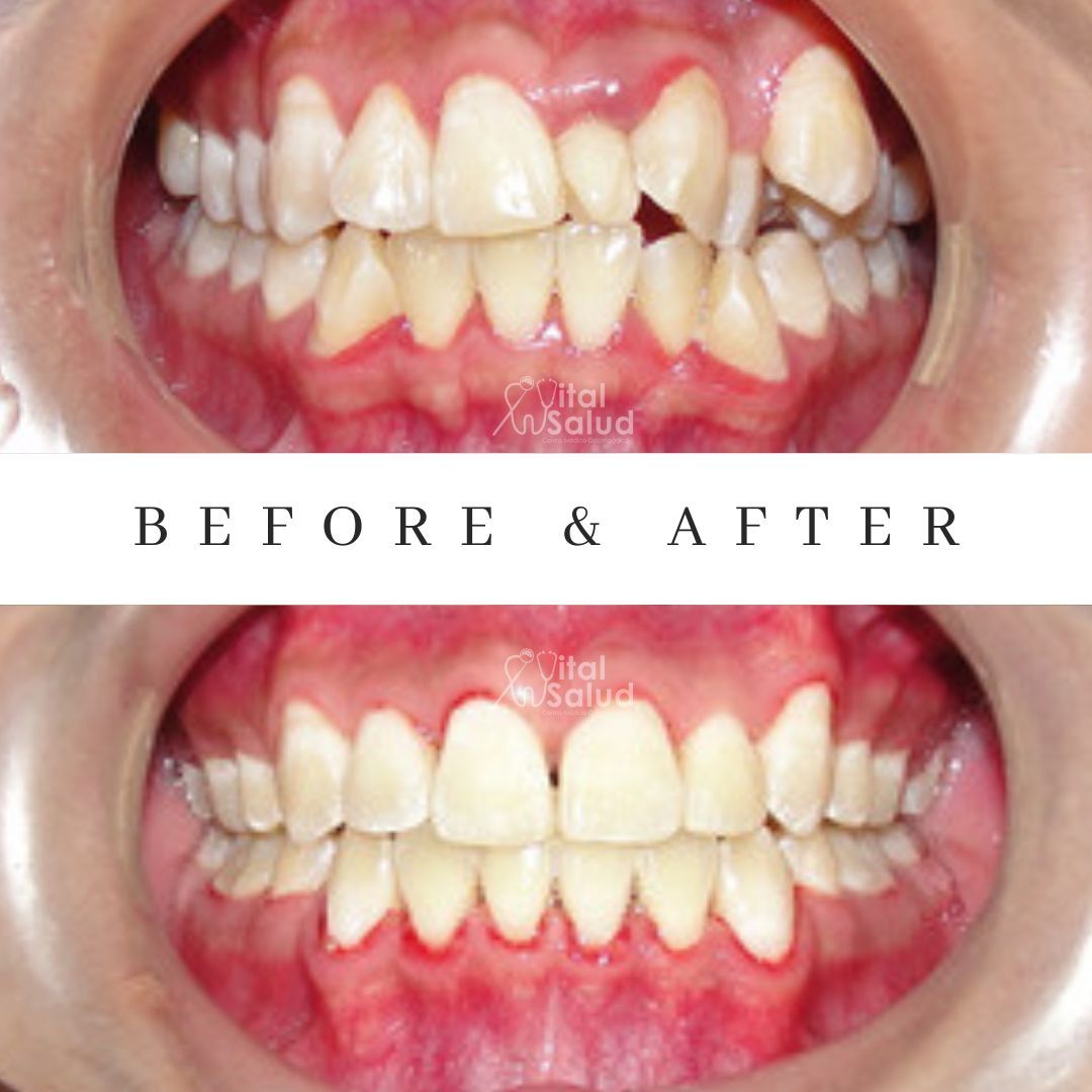 Dennis Ulloa Pinedo-3